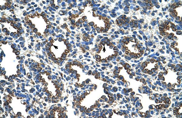 Antibody used in IHC on Human Lung at 4.0-8.0 ug/ml.
