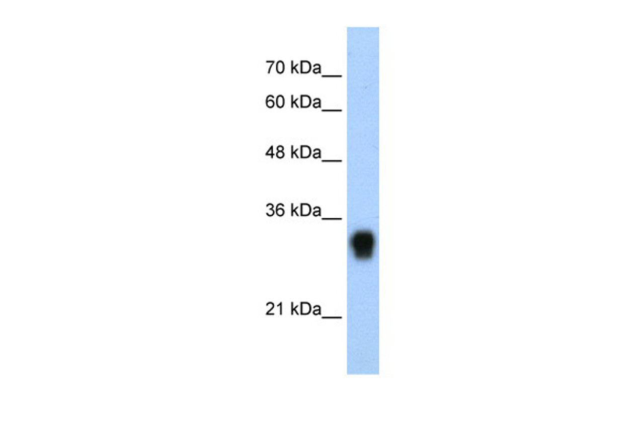 Antibody used in WB on Human HepG2 at 0.3125 ug/ml.