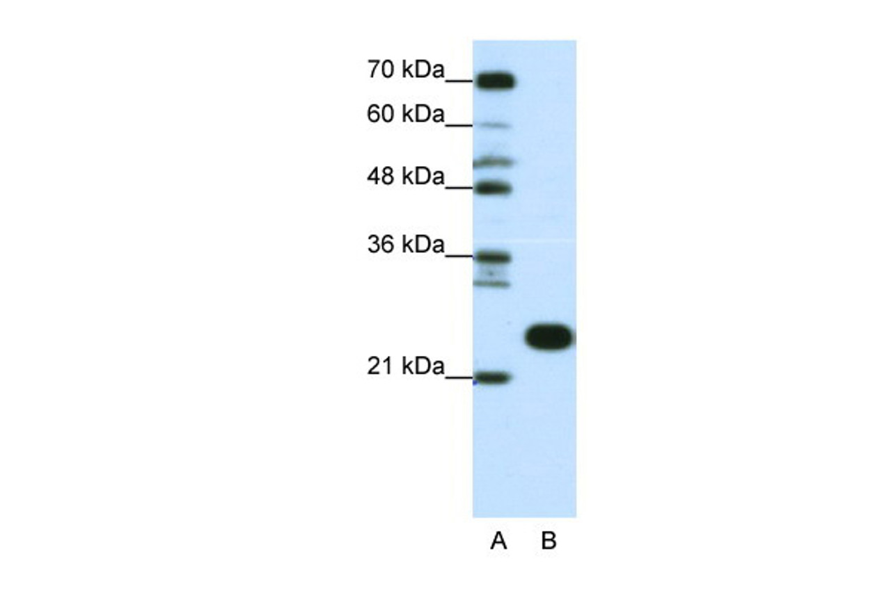 Antibody used in WB on Human Jurkat 5 ug/ml.