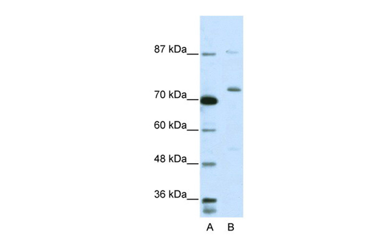 Antibody used in WB on Human Jurkat 5.0 ug/ml.