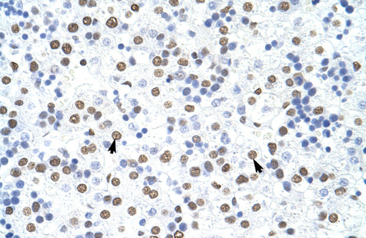 Antibody used in IHC on Human Liver at 4.0-8.0 ug/ml.