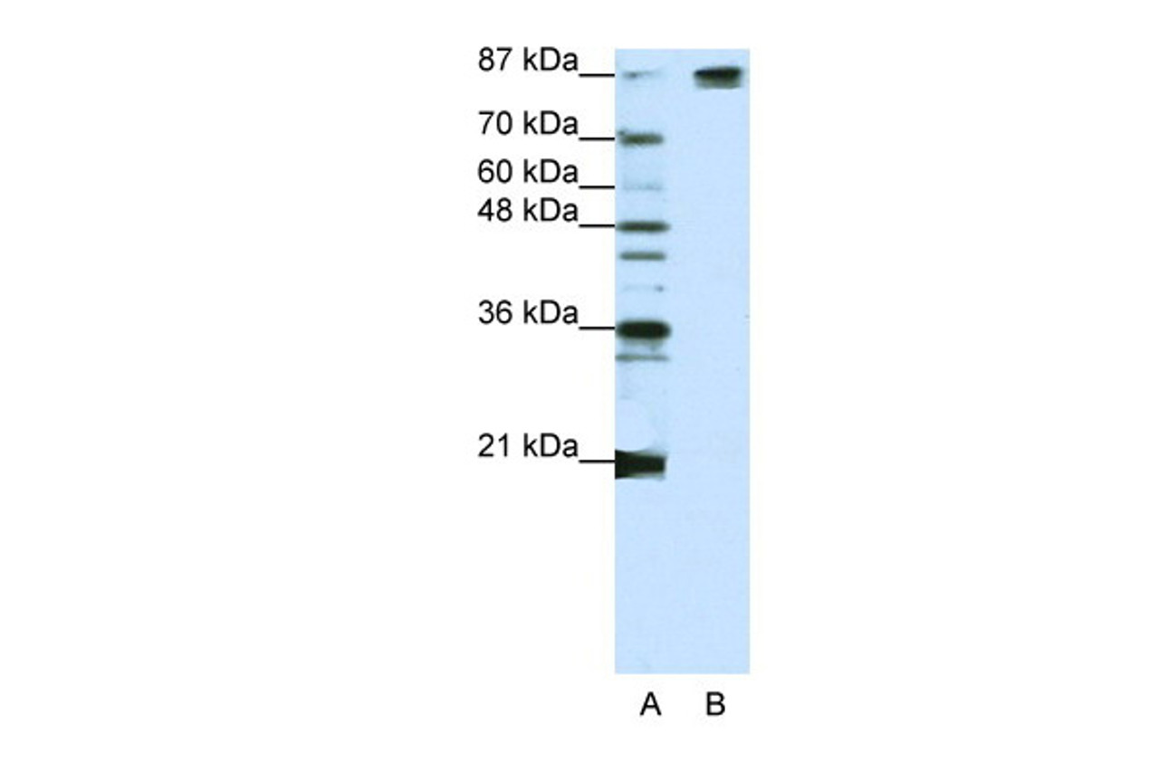 Antibody used in WB on Human Jurkat cells at 1.25 ug/ml.