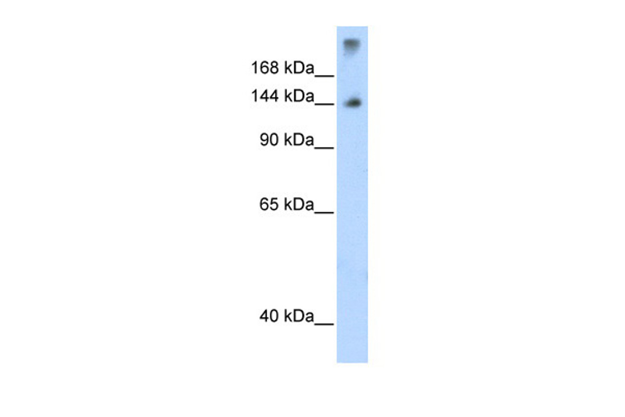 Antibody used in WB on Human Thymus at 1.25 ug/ml.