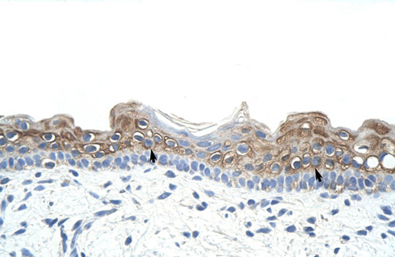 Antibody used in IHC on Human Skin at 4.0-8.0 ug/ml.