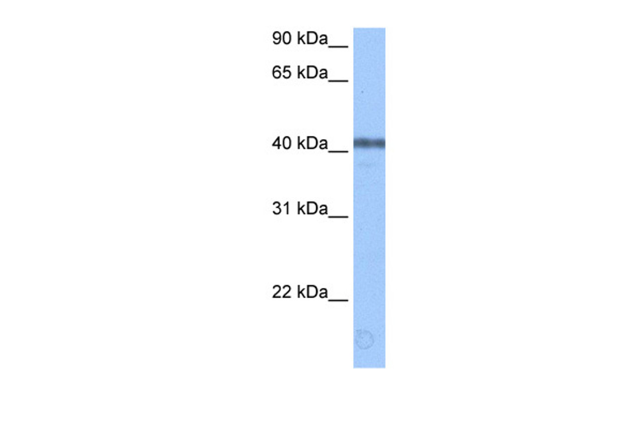 Antibody used in WB on Human Brain at 0.2-1 ug/ml.