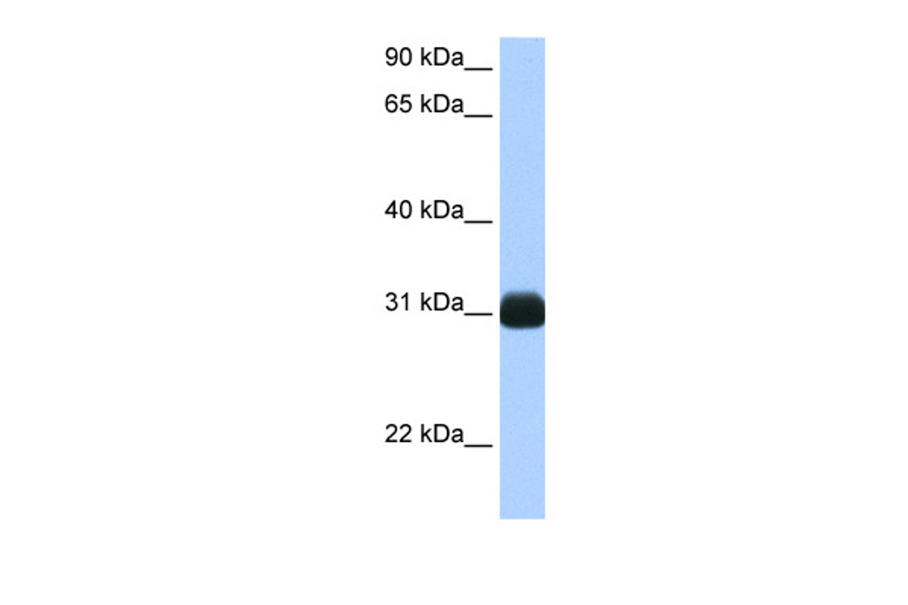 Antibody used in WB on Human Liver at 0.5 ug/ml.