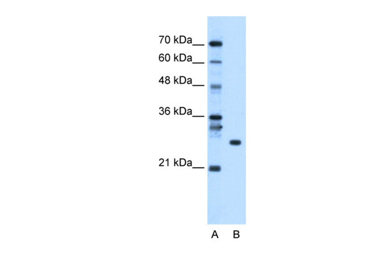 Antibody used in WB on Human Liver at 0.5 ug/ml.