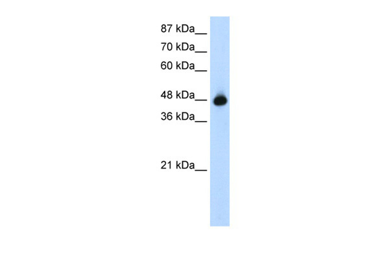 Antibody used in WB on Human HepG2 at 1.25 ug/ml.