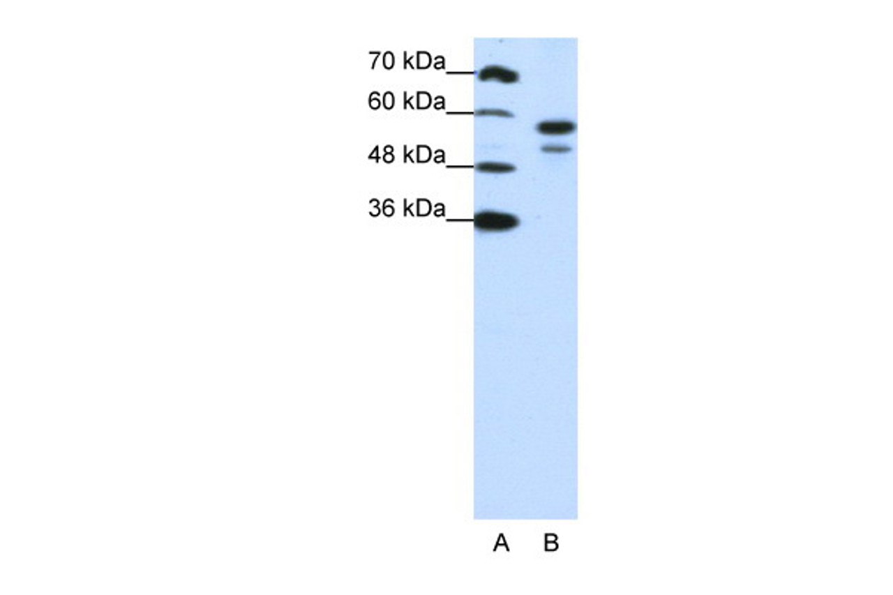 Antibody used in WB on Human Jurkat cells at 1.25 ug/ml.