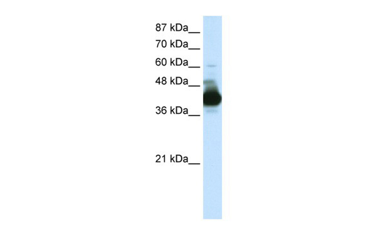 Antibody used in WB on Human Jurkat cells at 0.2-1 ug/ml.