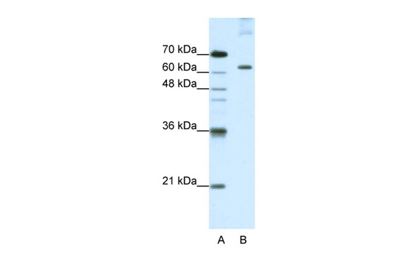 Antibody used in WB on Human HepG2 at 1.25 ug/ml.