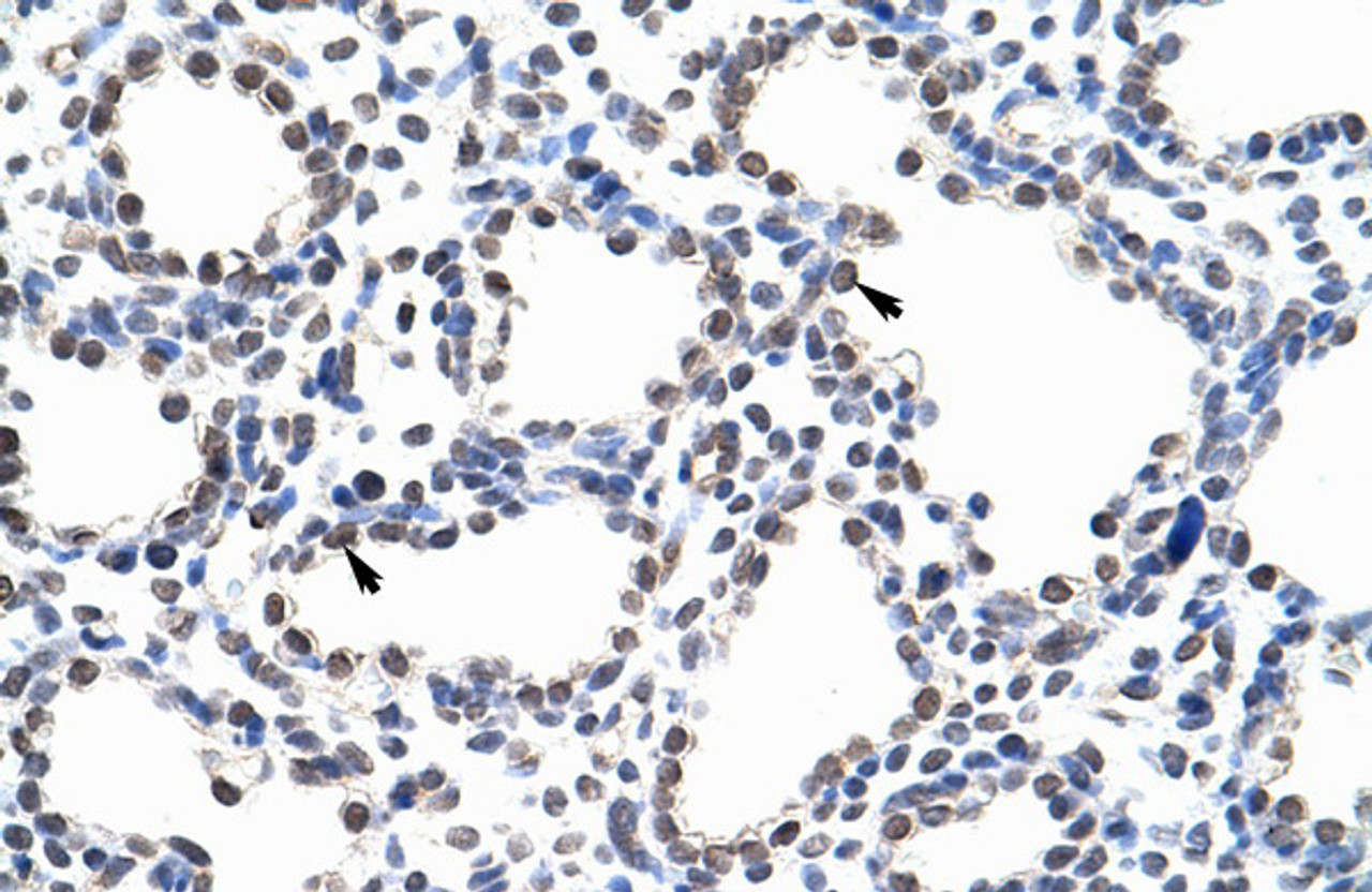 Antibody used in IHC on Human Lung at 4.0-8.0 ug/ml.