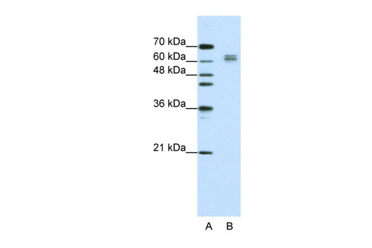 Antibody used in WB on Human Jurkat cells at 1.25 ug/ml.