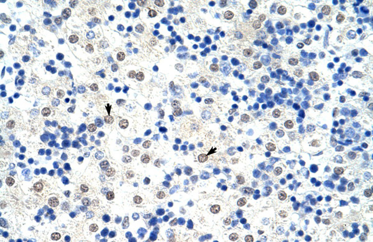 Antibody used in IHC on Human Liver at 4.0-8.0 ug/ml.