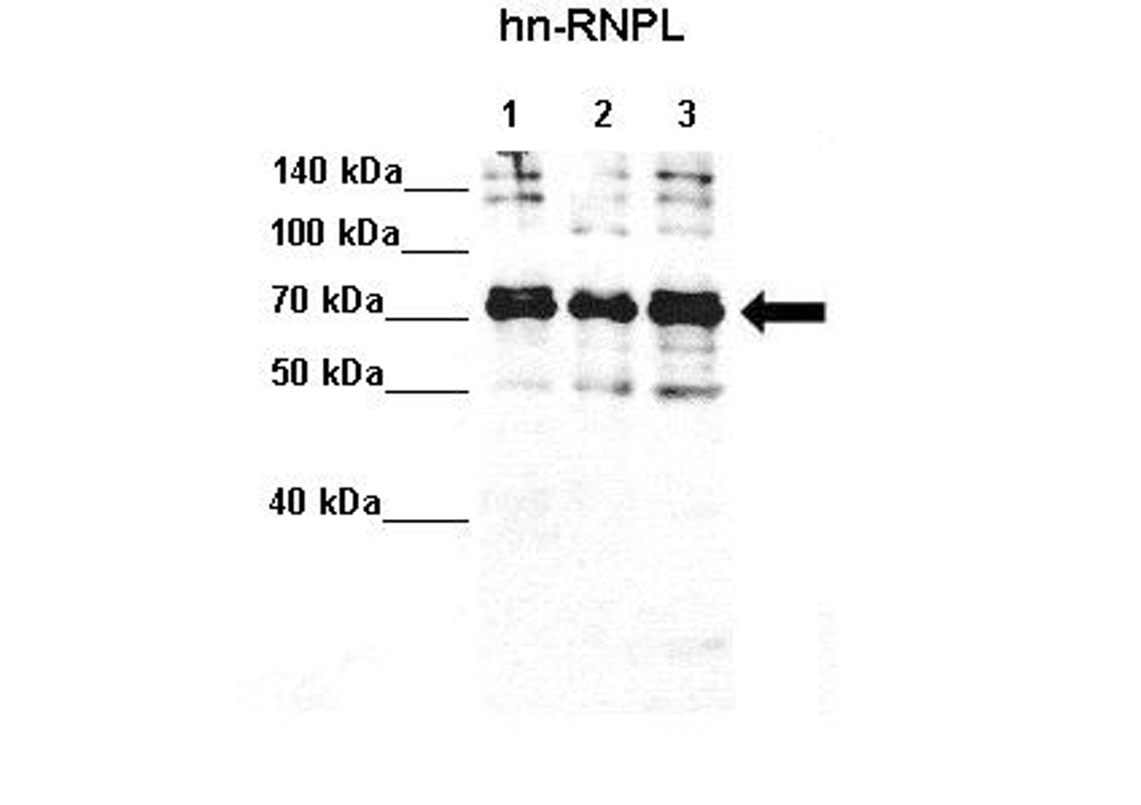 Antibody used in WB on HeLa S3, MCF7, K562 at 1:4000 (Lane 1: 20ug HeLa S3 lysate Lane 2: 20ug MCF7 lysate Lane 3: 20ug K562 lysate) .
