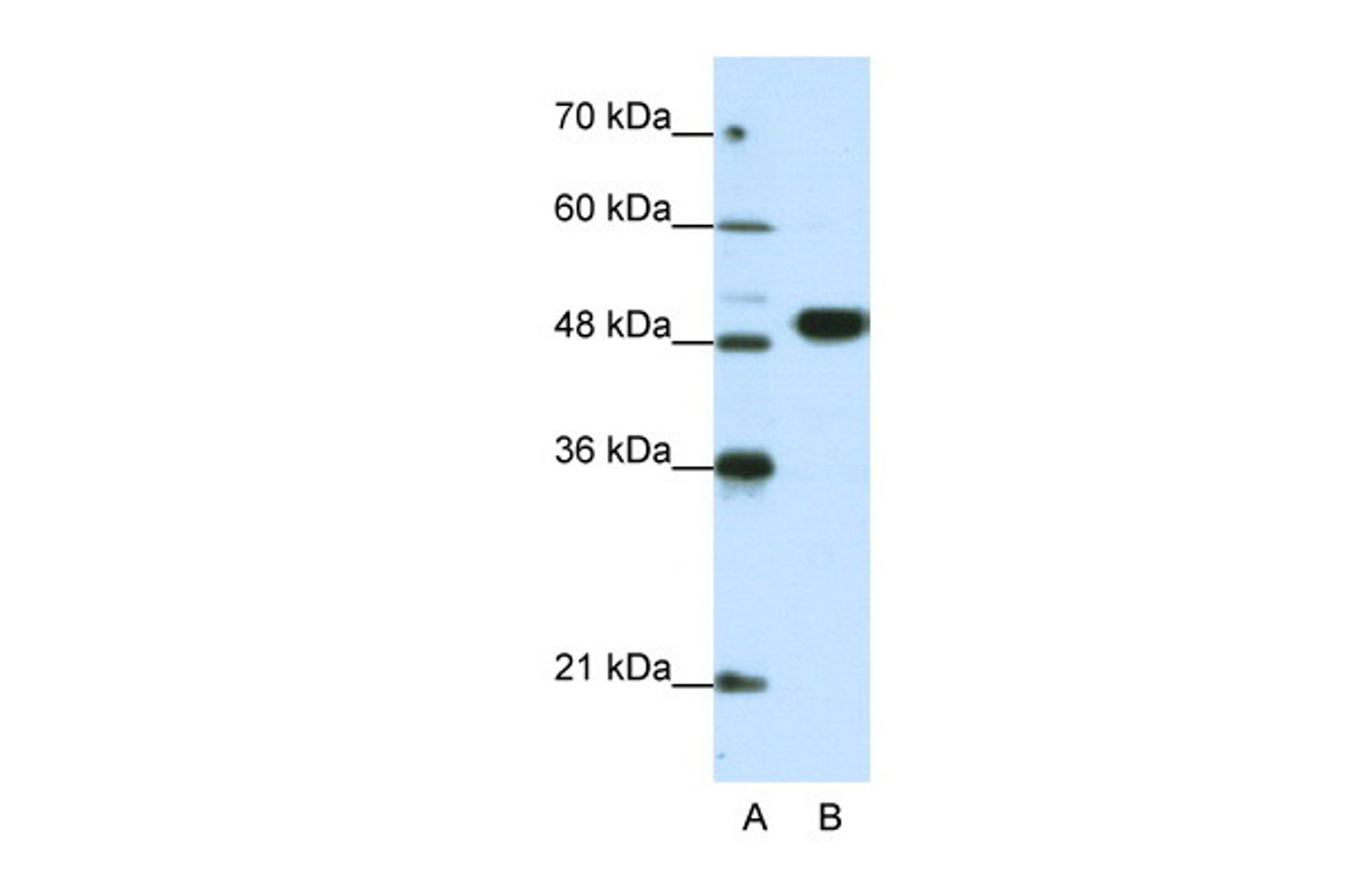 Antibody used in WB on Human Jurkat 0.2-1 ug/ml.