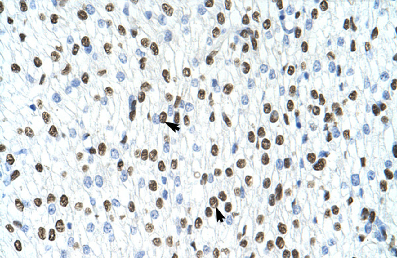 Antibody used in IHC on Human Heart at 4.0-8.0 ug/ml.