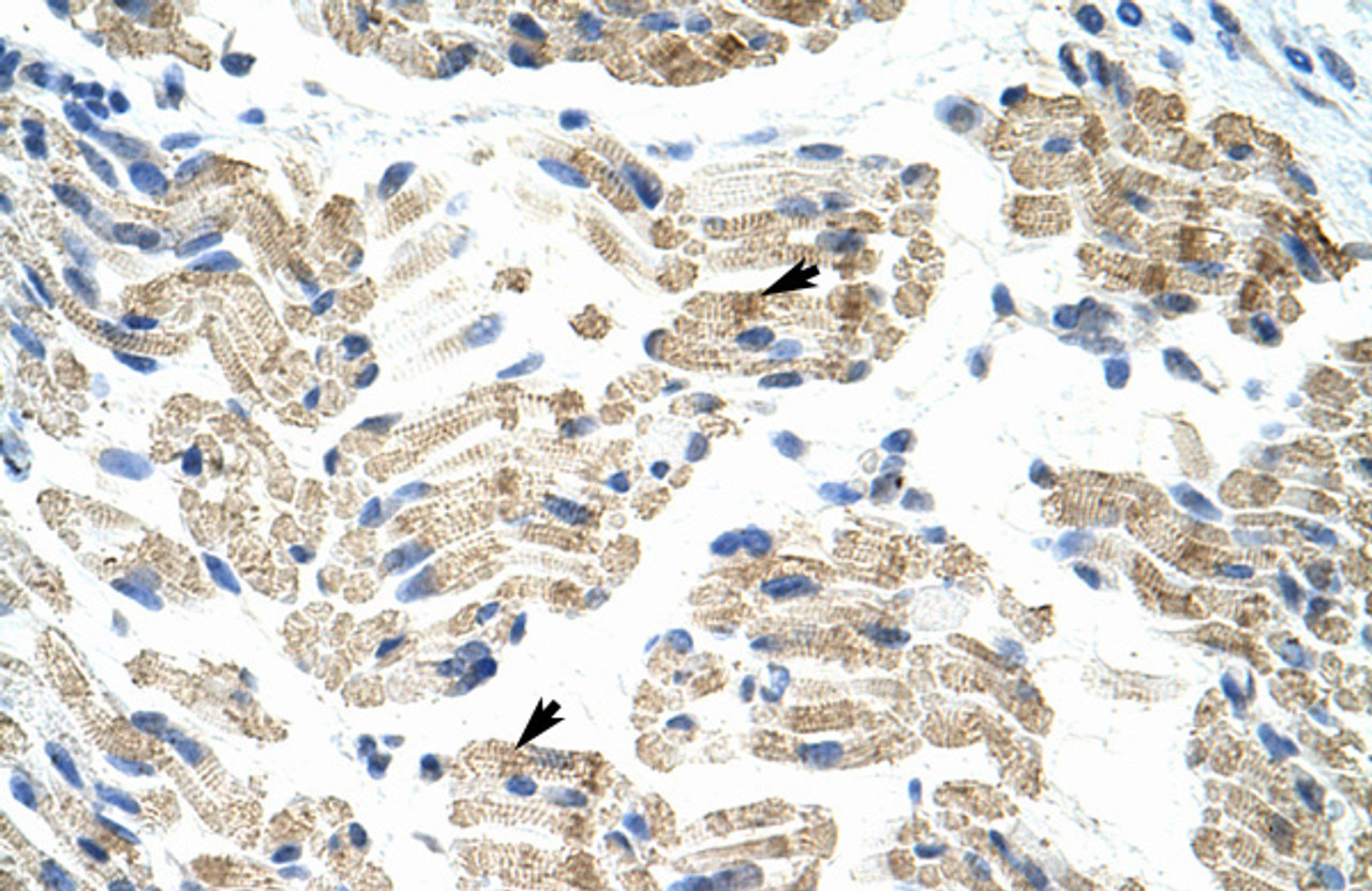 Antibody used in IHC on Human Muscle at 4.0-8.0 ug/ml.