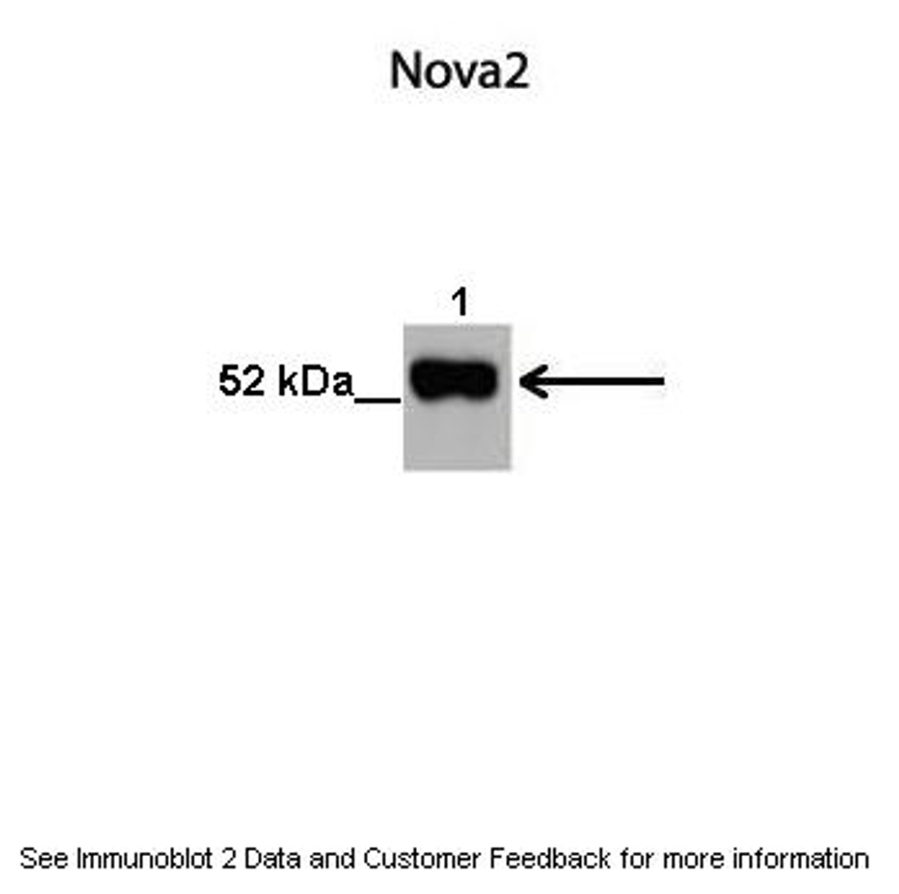 Antibody used in WB on Human neural tube at 1:1000 (Lane 1. 10 ug human neural cell lysate, Lane 2. 10 ug human non-neural cell lysate) .