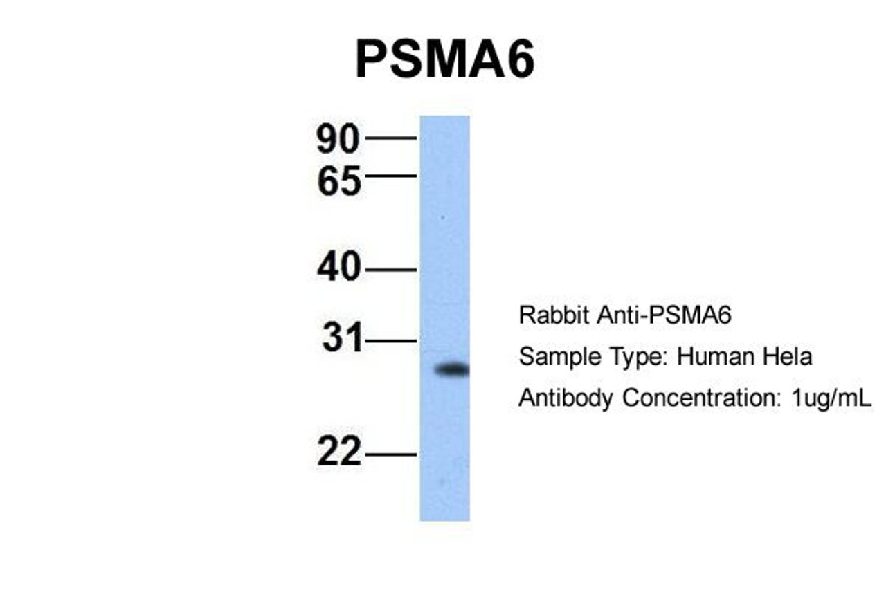 Antibody used in WB on Human Hela at 1 ug/ml.