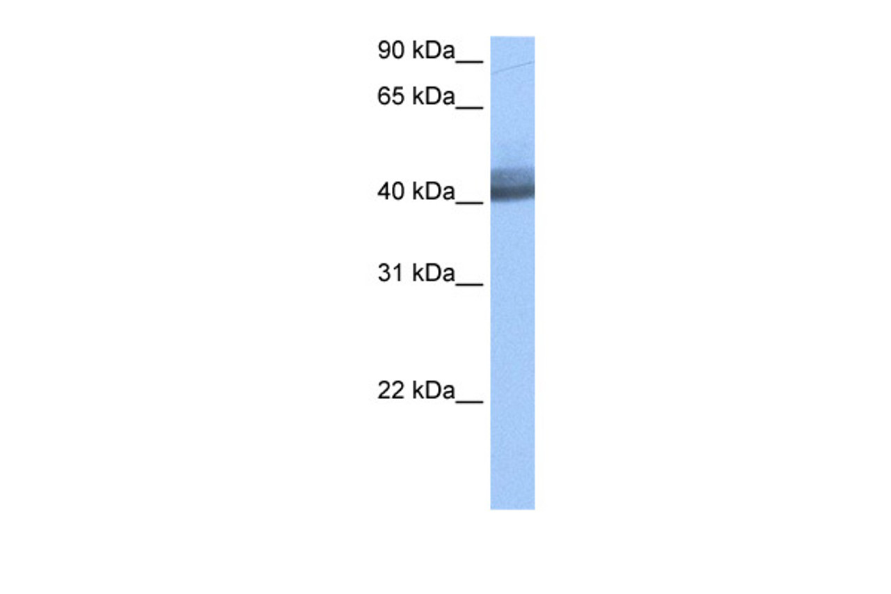 Antibody used in WB on Human MCF7 cells at 0.2-1 ug/ml.
