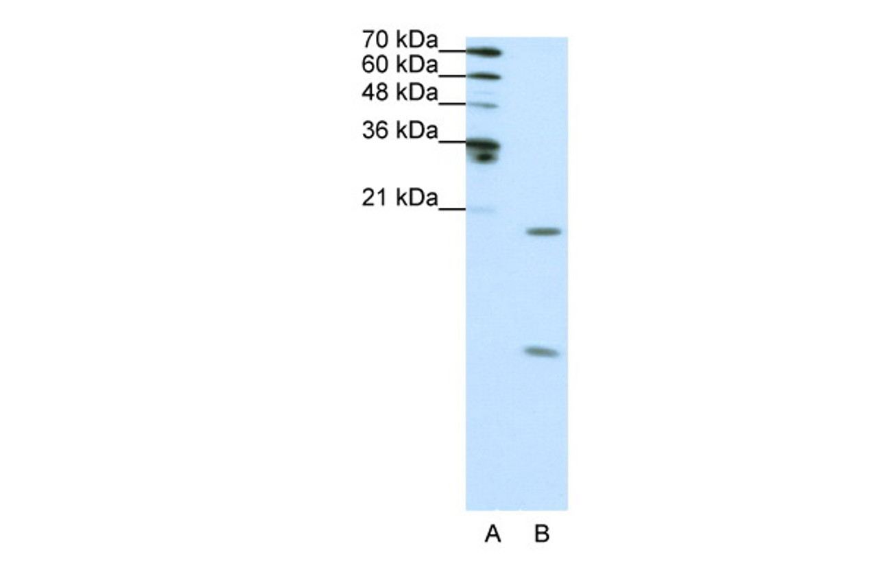 Antibody used in WB on Human HepG2 at 1 ug/ml.