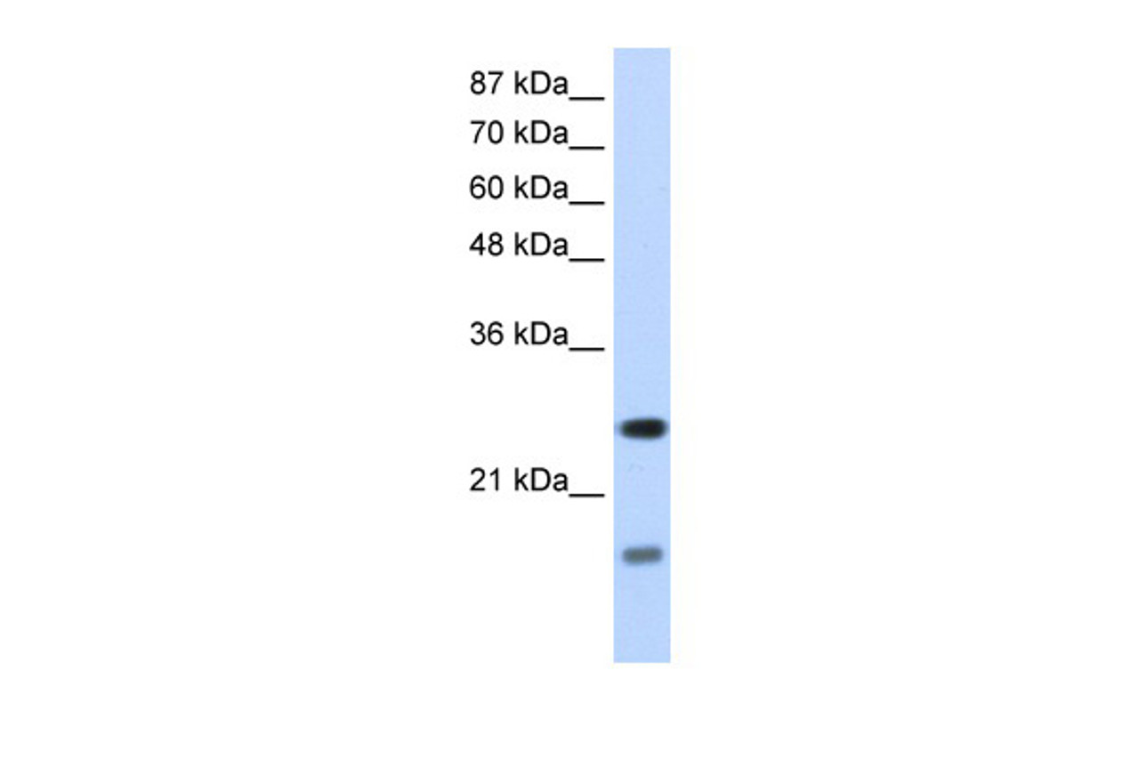 Antibody used in WB on Human HepG2 at 1.25 ug/ml.