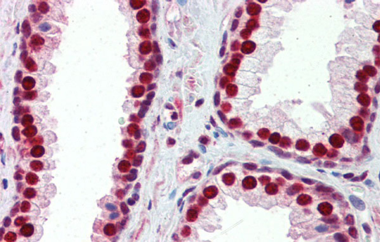 Antibody used in IHC on Human Prostate at 5.0 ug/ml.