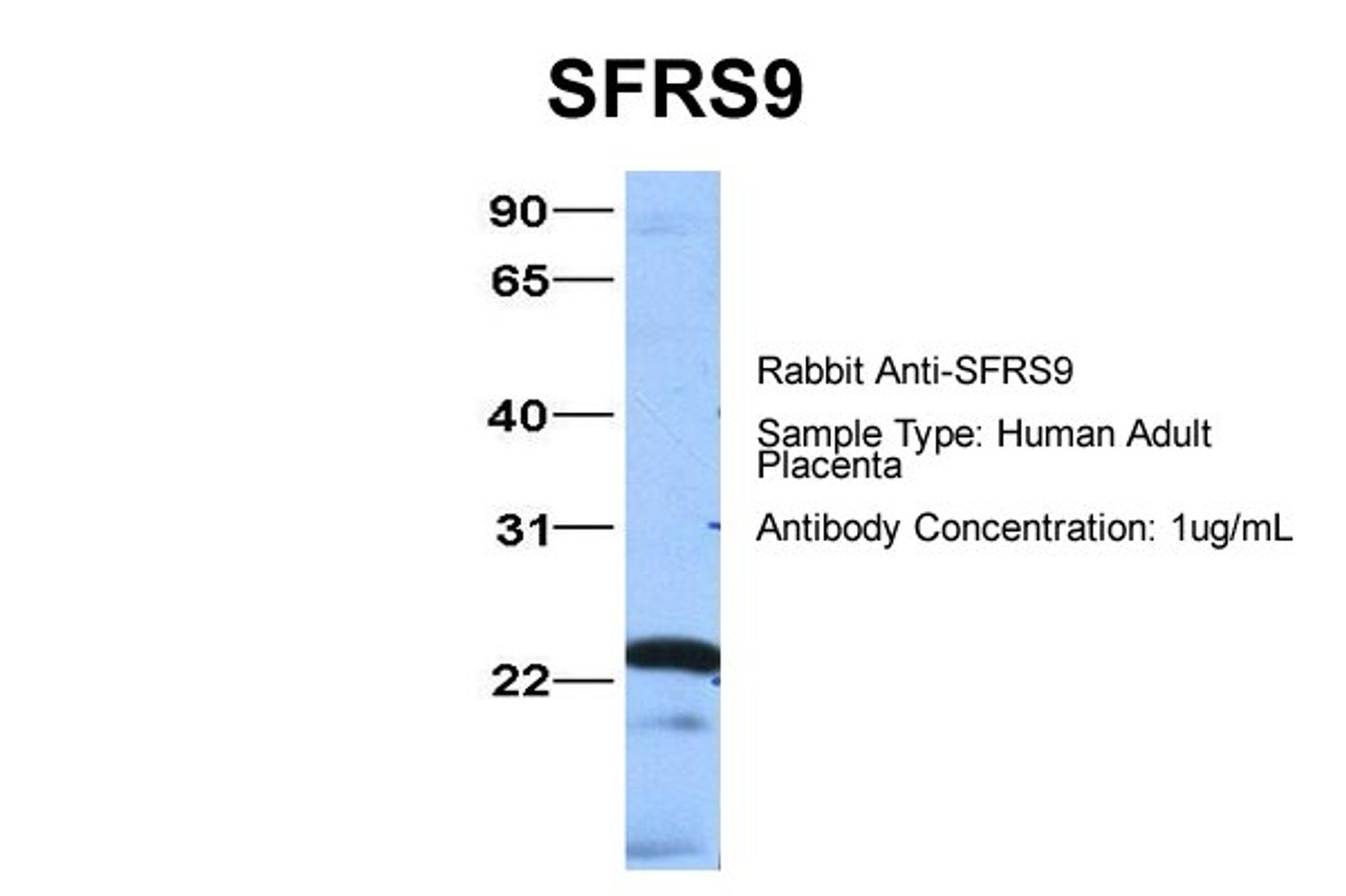 Antibody used in WB on Hum. Adult Placenta at 1 ug/ml.