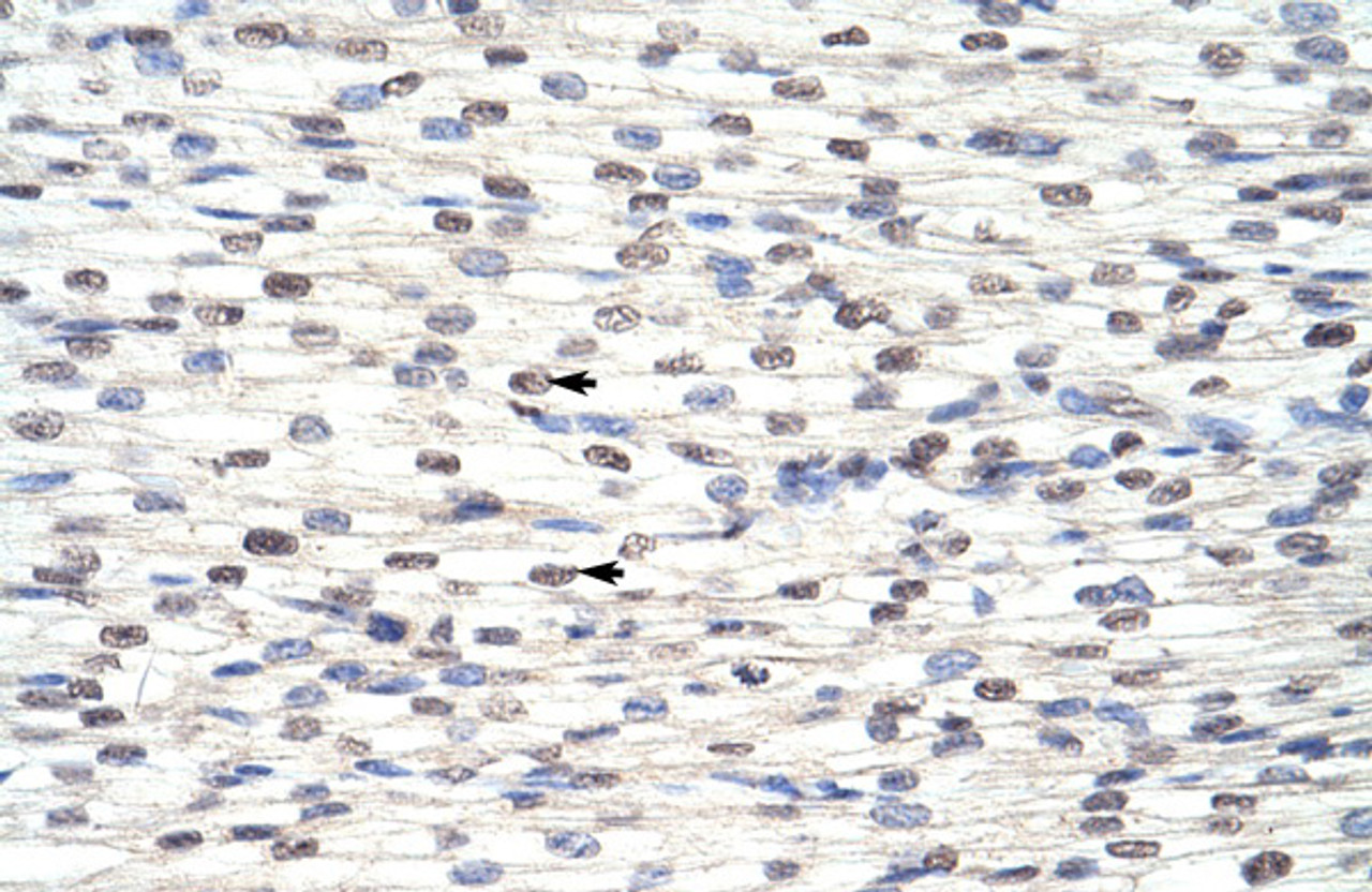 Antibody used in IHC on Human Heart at 4.0-8.0 ug/ml.