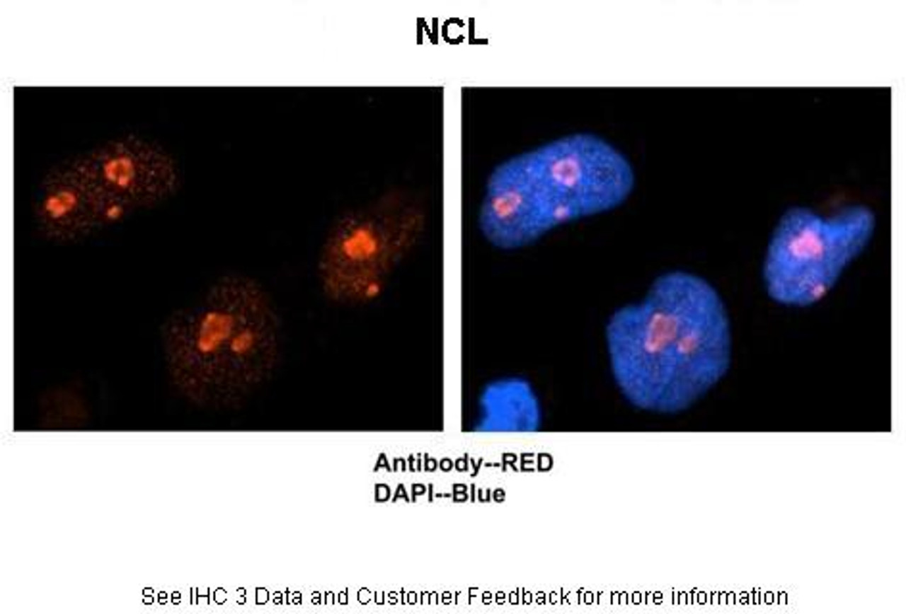 Antibody used in IHC on Human NT-2 at 1:500.