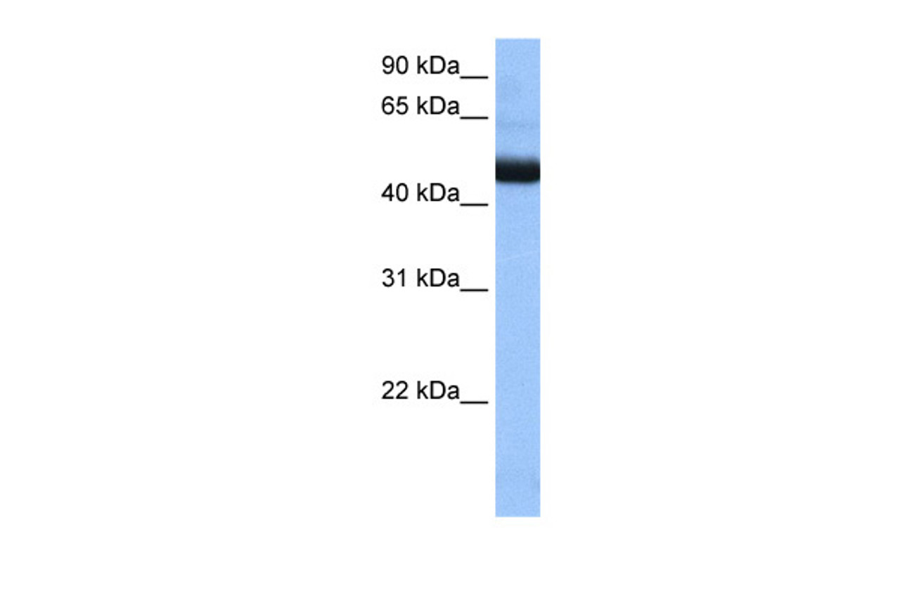 Antibody used in WB on Human Jurkat 0.2-1 ug/ml.