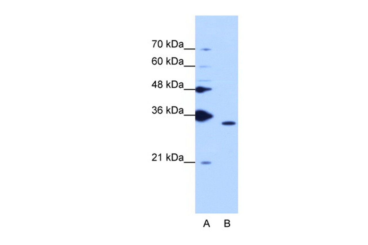 Antibody used in WB on Human K562 cells at 1.25 ug/ml.