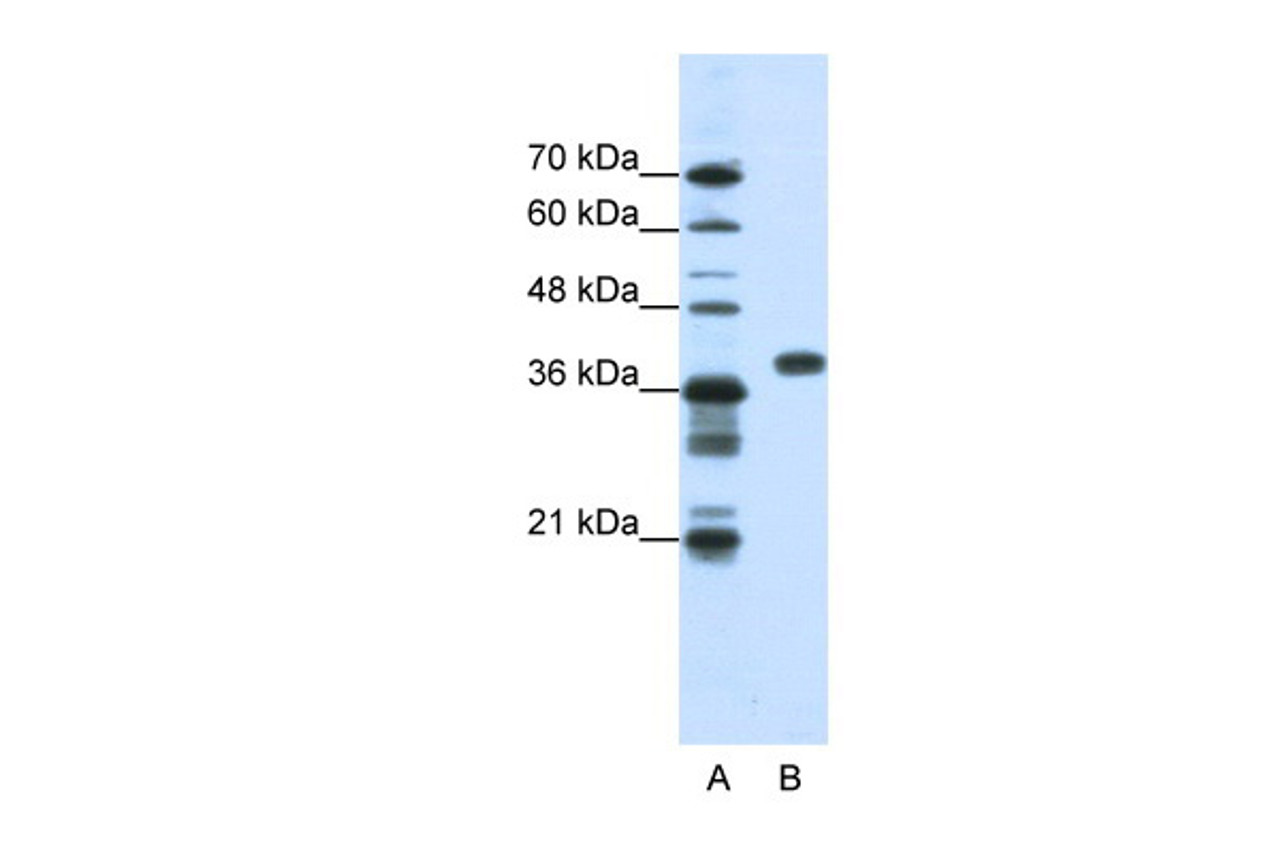 Antibody used in WB on Human HepG2 at 1.25 ug/ml.