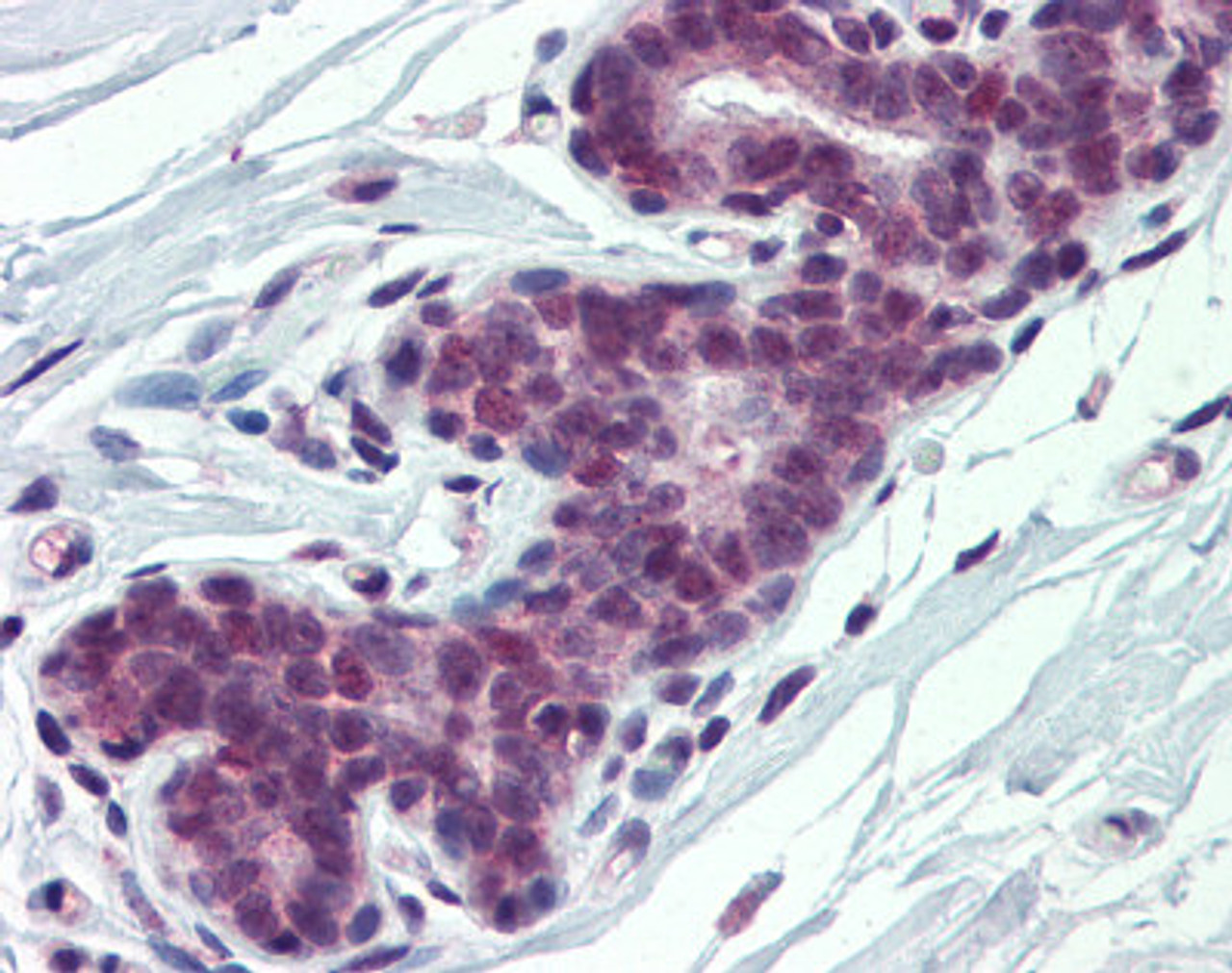 Antibody used in IHC on Human Breast at 5 ug/ml.