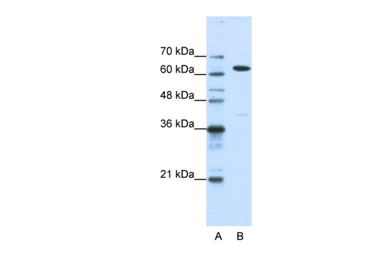 Antibody used in WB on Human HepG2 at 1.25 ug/ml.