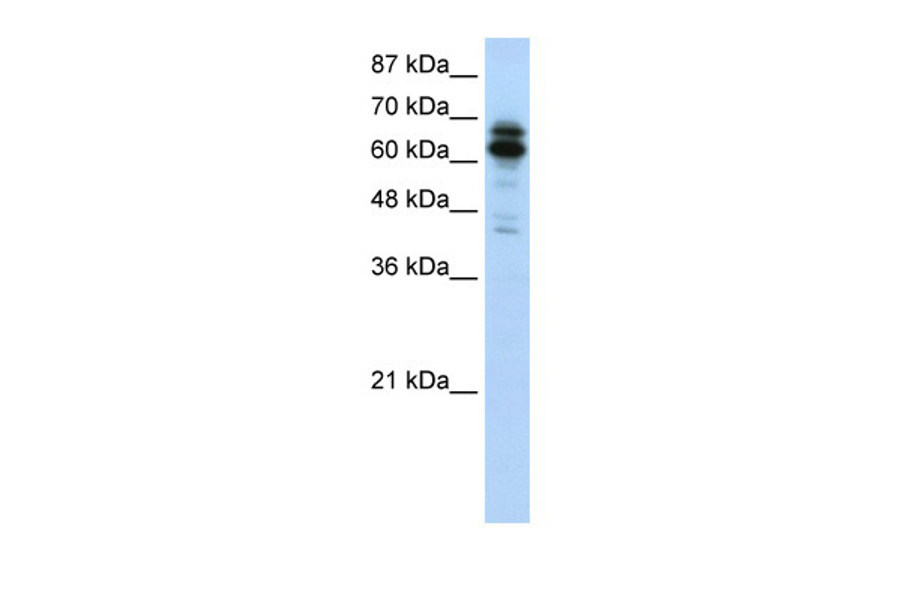 Antibody used in WB on Human HepG2 at 1.25 ug/ml.