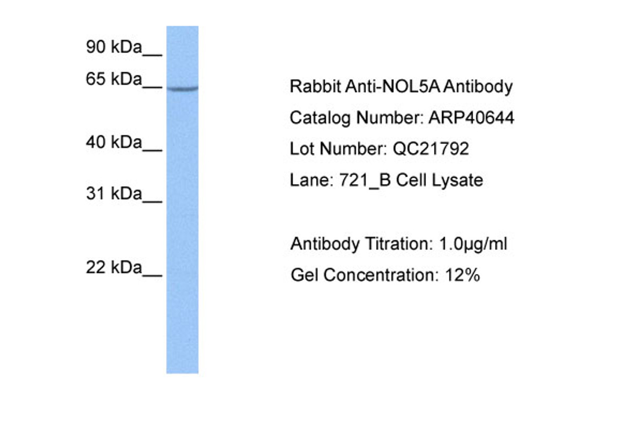 Antibody used in WB on Human 721_B at 1 ug/ml.