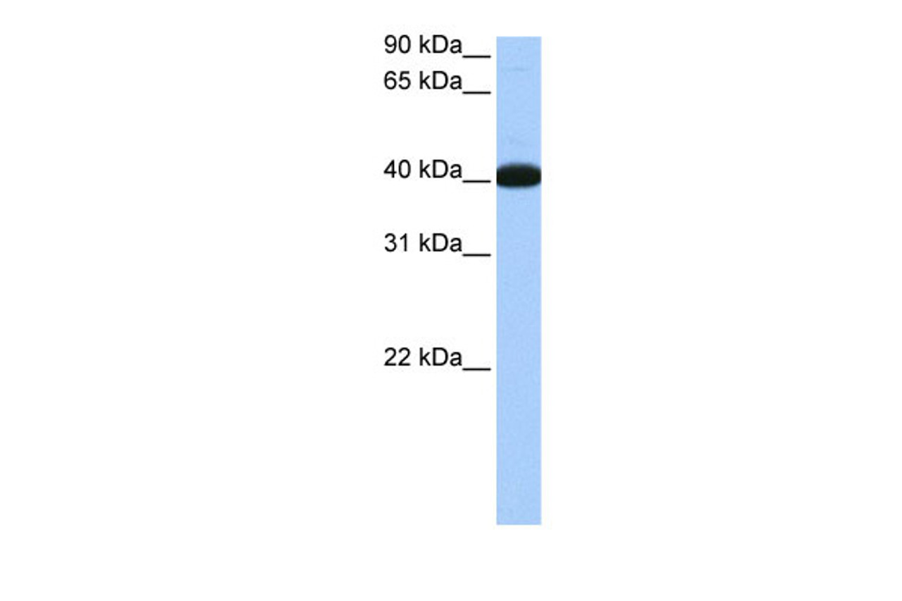 Antibody used in WB on Human Lung at 0.2-1 ug/ml.