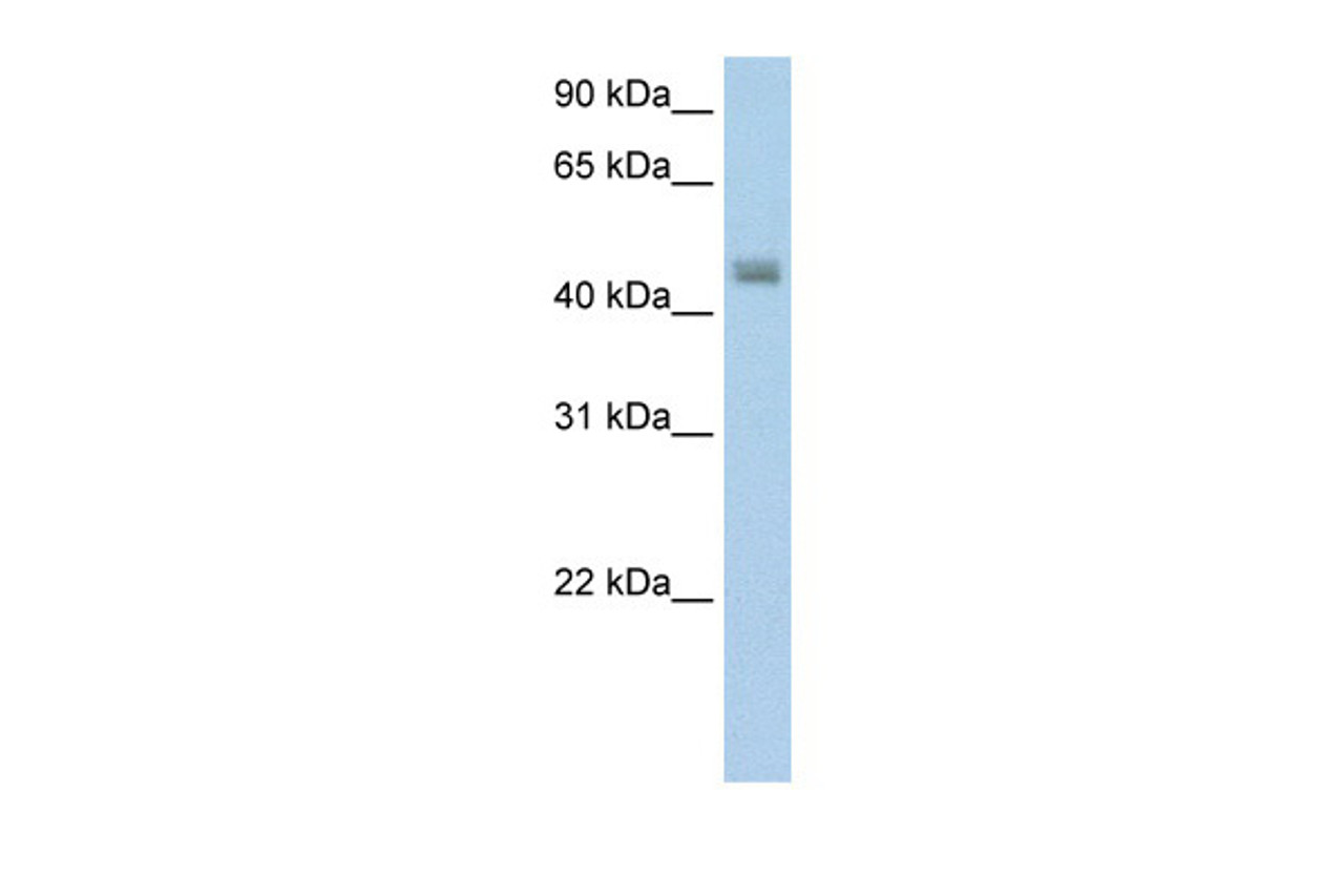 Antibody used in WB on Transfected 293T at 5.0 ug/ml.