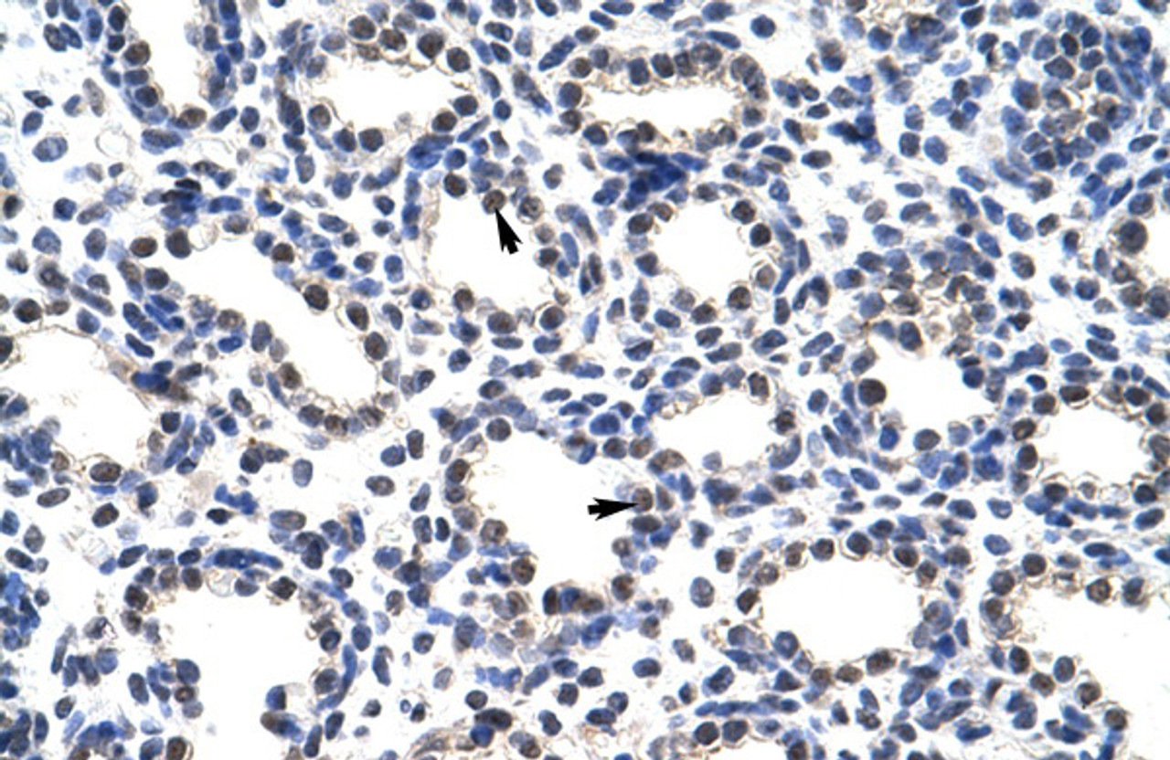 Antibody used in IHC on Human Lung at 4.0-8.0 ug/ml.