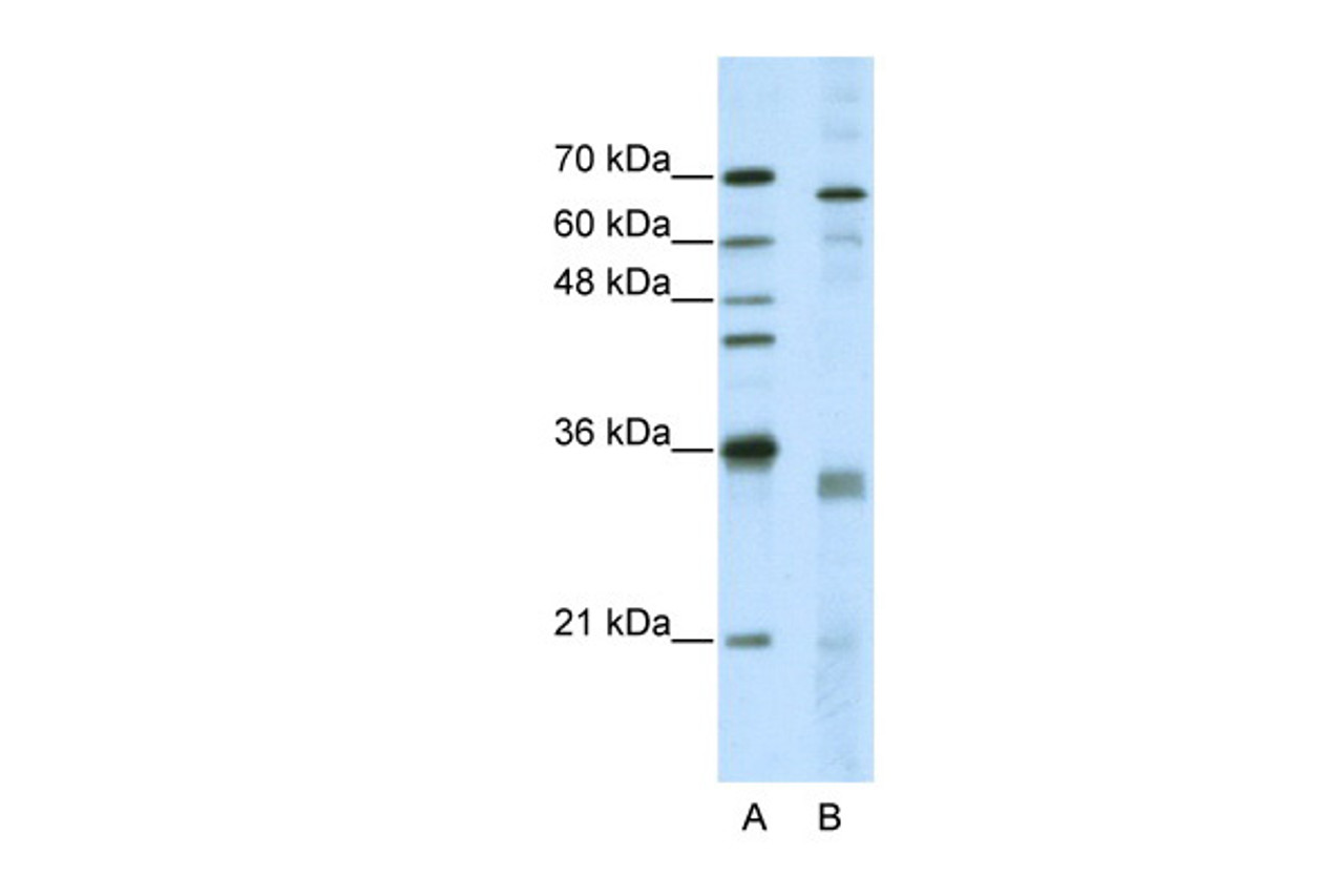 Antibody used in WB on Human HepG2 at 5.0 ug/ml.