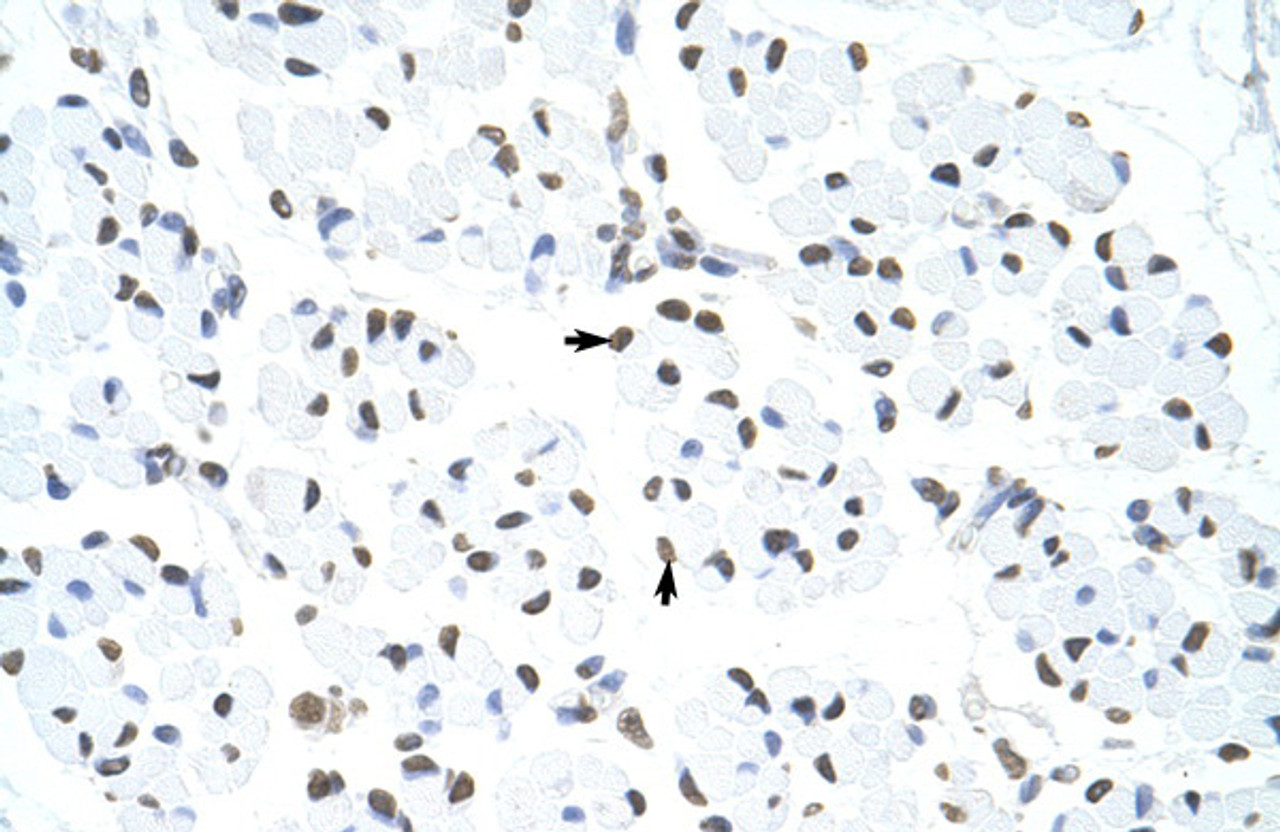 Antibody used in IHC on Human Muscle at 4.0-8.0 ug/ml.