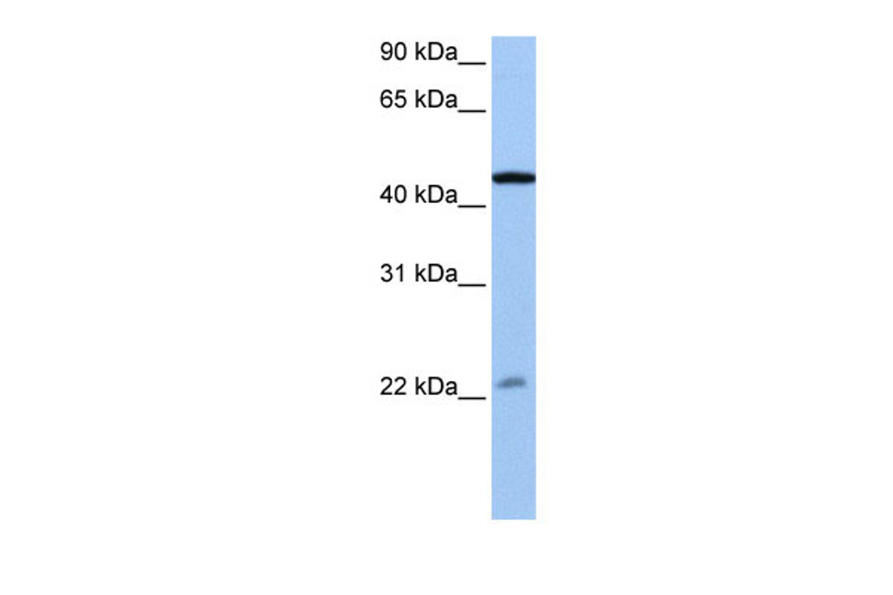 Antibody used in WB on Human Jurkat cells at 0.2-1 ug/ml.
