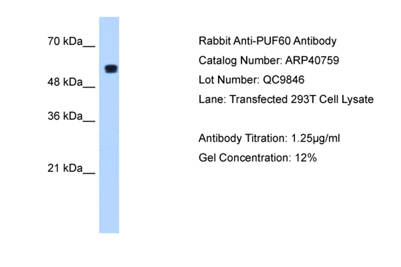 Antibody used in WB on Human 293T at 1.25 ug/ml.