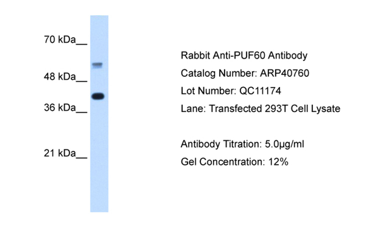 Antibody used in WB on Human 293T at 0.5 ug/ml.