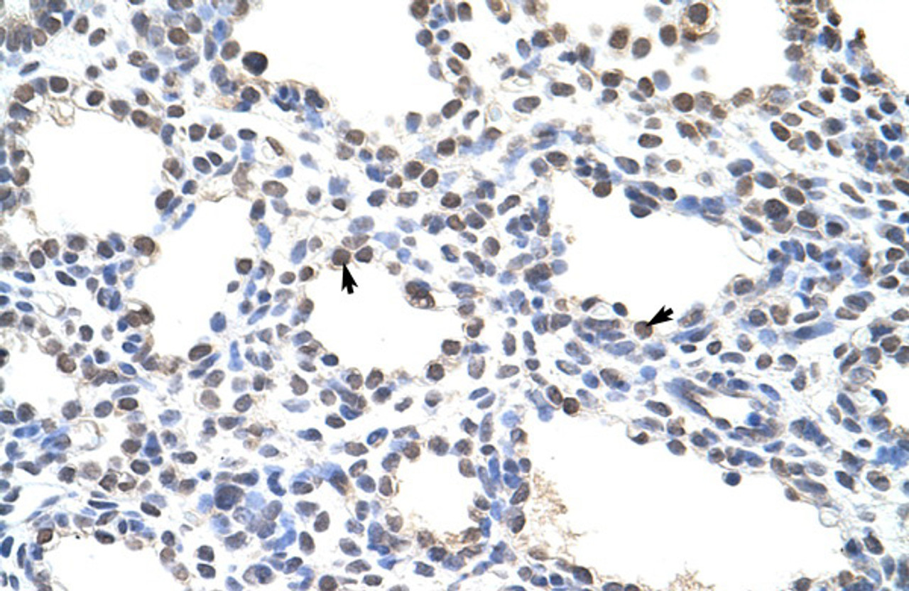 Antibody used in IHC on Human Lung at 4.0-8.0 ug/ml.