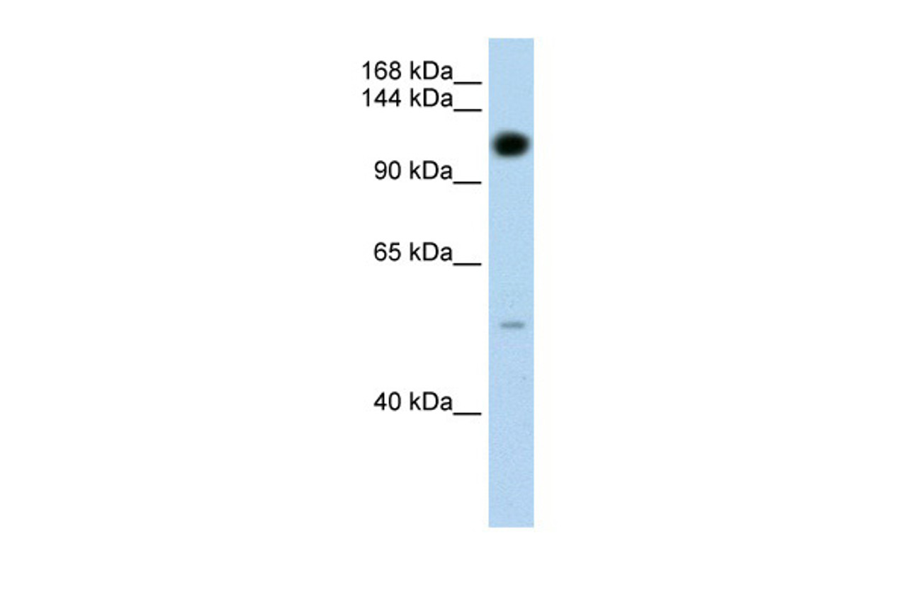 Antibody used in WB on Transfected 293T at 1.25 ug/ml.