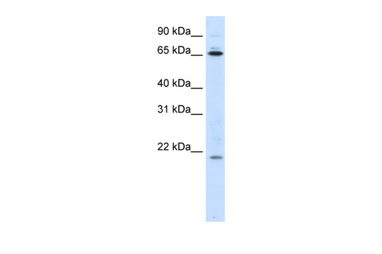 Antibody used in WB on Human SW620 at 0.2-1 ug/ml.