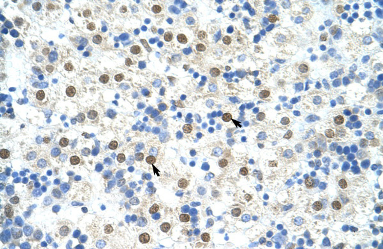 Antibody used in IHC on Human Liver at 4.0-8.0 ug/ml.